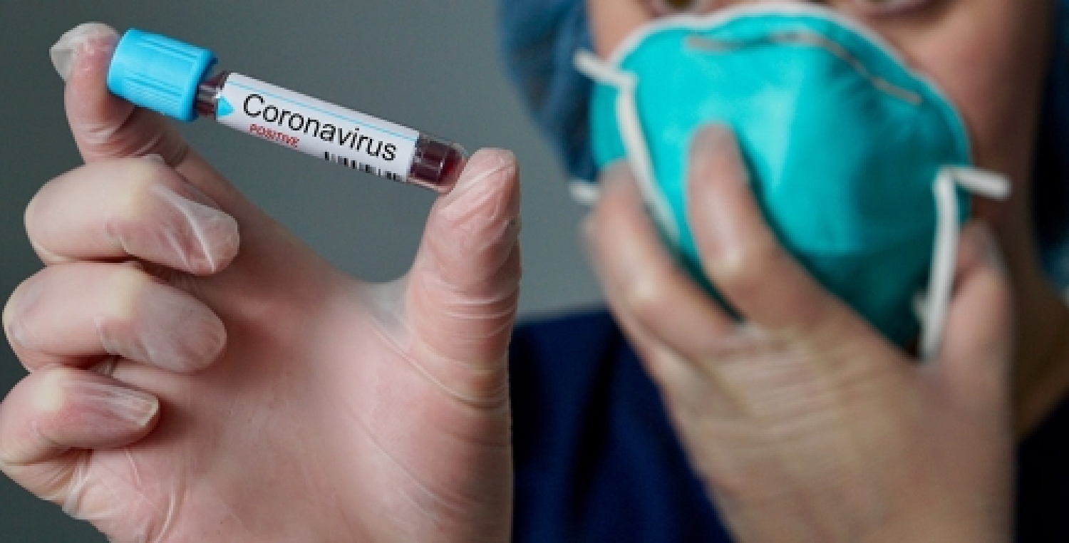 coronavirus-tampone-positivo.jpg