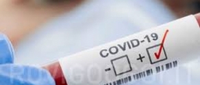 covid positivo.jpg
